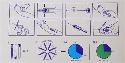 6/8x15 мл портативное устройство центрифуги PRP 0-4000rpm для больниц косметической хирургии